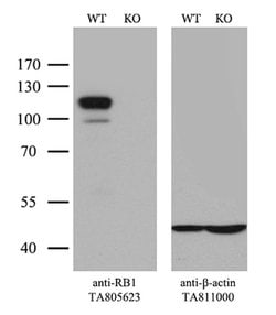 RB1 Monoclonal Antibody (OTI11C10), TrueMAB , OriGene 100 &mu;L; Unconjugated:Antibodies,