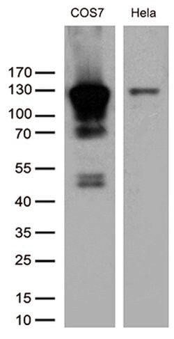 RB1 Monoclonal Antibody (OTI11C10), TrueMAB , OriGene 100 &mu;L; Unconjugated:Antibodies,