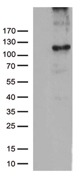 RB1 Mouse anti-Human, Clone: OTI13A6, lyophilized, TrueMAB 100 &mu;g; Unconjugated:Antibodies,