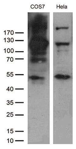 RB1 Mouse anti-Human, Clone: OTI13A6, lyophilized, TrueMAB 100 &mu;g; Unconjugated:Antibodies,