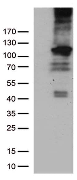RB1 Monoclonal Antibody (OTI1C3), TrueMAB , OriGene 100 &mu;L; Unconjugated:Antibodies,
