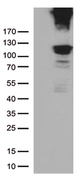 RB1 Monoclonal Antibody (OTI11C5), TrueMAB , OriGene:Antibodies:Primary