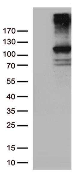 RB1 Monoclonal Antibody (OTI3F11), TrueMAB , OriGene 100 &mu;L; Unconjugated:Antibodies,