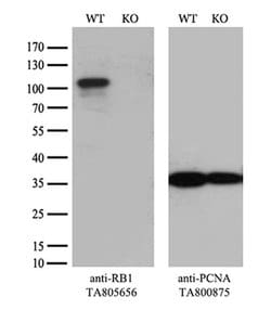 RB1 Monoclonal Antibody (OTI3F11), TrueMAB , OriGene 100 &mu;L; Unconjugated:Antibodies,