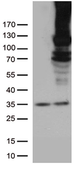 RB1 Mouse anti-Human, Clone: OTI1B1, lyophilized, TrueMAB 100 &mu;g | Buy Online | OriGene | Fisher Scientific
