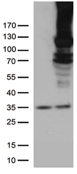 RB1 Monoclonal Antibody (OTI1B1), TrueMAB , OriGene 100 &mu;L; Unconjugated:Antibodies,