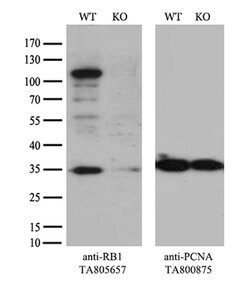 RB1 Mouse anti-Human, Clone: OTI1B1, lyophilized, TrueMAB 100 &mu;g | Buy Online | OriGene | Fisher Scientific