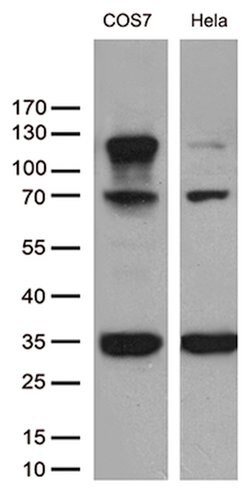 RB1 Mouse anti-Human, Clone: OTI1B1, lyophilized, TrueMAB 100 &mu;g | Buy Online | OriGene | Fisher Scientific