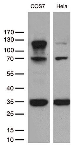 RB1 Monoclonal Antibody (OTI1B1), TrueMAB , OriGene 100 &mu;L; Unconjugated:Antibodies,