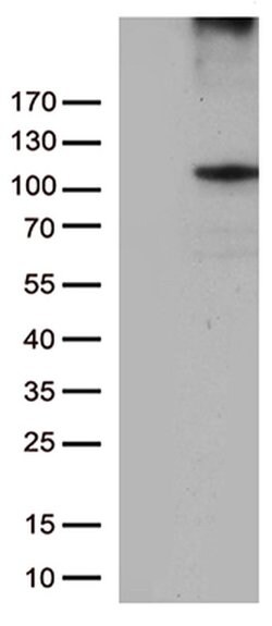 RB1 Monoclonal Antibody (OTI10H9), TrueMAB , OriGene 30 &mu;L; Unconjugated:Antibodies,