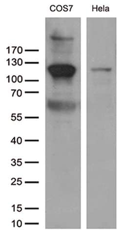 RB1 Monoclonal Antibody (OTI10H9), TrueMAB , OriGene 30 &mu;L; Unconjugated:Antibodies,
