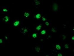 RBBP7 Monoclonal Antibody (OTI2D8), TrueMAB , OriGene 30 &mu;L; Unconjugated:Antibodies,
