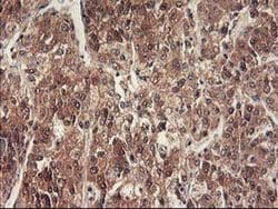 RBBP7 Monoclonal Antibody (OTI5A4), TrueMAB , OriGene 30 &mu;L; Unconjugated:Antibodies,