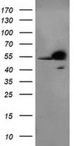 RBBP7 Monoclonal Antibody (OTI5A4), TrueMAB , OriGene 30 &mu;L; Unconjugated:Antibodies,