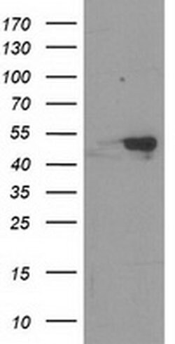RBBP7 Monoclonal Antibody (OTI3A12), TrueMAB , OriGene 100 &mu;L; Unconjugated:Antibodies,
