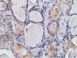 RBBP9 Mouse anti-Human, Clone: OTI4G9, lyophilized, TrueMAB 100 &mu;g | Buy Online | OriGene | Fisher Scientific