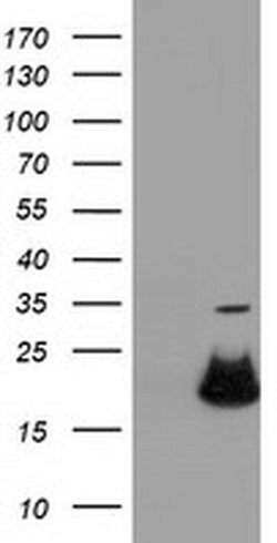 RBBP9 Monoclonal Antibody (OTI2G2), TrueMAB , OriGene 100 &mu;L; Unconjugated:Antibodies,