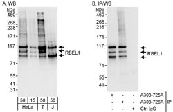 RBEL1 Rabbit anti-Human, Polyclonal, Bethyl Laboratories 100 &mu;L; Unconjugated:Antibodies,