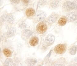 RBM10 Rabbit anti-Human, Polyclonal, Bethyl Laboratories 100 &mu;L; Unconjugated:Antibodies,