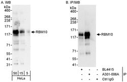 RBM10 Rabbit anti-Human, Polyclonal, Bethyl Laboratories 100 &mu;L; Unconjugated:Antibodies,