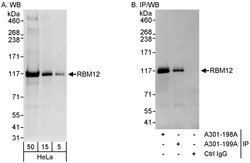 RBM12 Rabbit anti-Human, Polyclonal, Bethyl Laboratories 100 &mu;L; Unconjugated:Antibodies,