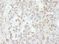 RBM16 Polyclonal Antibody, Bethyl Laboratories 10 &mu;L | Buy Online | Bethyl Laboratories, Inc | Fisher Scientific