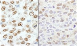 RBM25/RED120 Rabbit anti-Human, Mouse, Polyclonal, Bethyl Laboratories