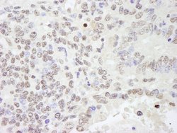 RBM25/RED120 Polyclonal Antibody, Bethyl Laboratories 100 &mu;L; Unconjugated:Antibodies,