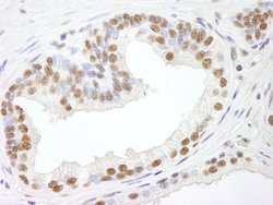 RBM25/RED120 Polyclonal Antibody, Bethyl Laboratories 100 &mu;L; Unconjugated:Antibodies,