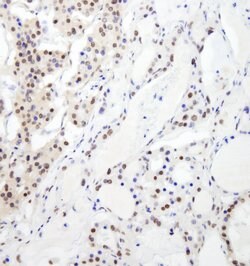 RBM26 Rabbit anti-Human, Polyclonal, Bethyl Laboratories 100 &mu;L; Unconjugated:Antibodies,