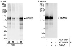 RBM26 Rabbit anti-Human, Polyclonal, Bethyl Laboratories 100 &mu;L; Unconjugated:Antibodies,