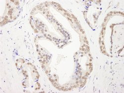 RBM26 Polyclonal Antibody, Bethyl Laboratories 100 &mu;L | Buy Online | Bethyl Laboratories, Inc | Fisher Scientific