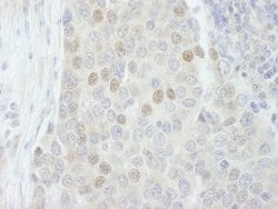 RBM27 Polyclonal Antibody, Bethyl Laboratories 100 &mu;L; Unconjugated:Antibodies,