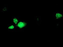 RBM46 Monoclonal Antibody (OTI1D6), TrueMAB , OriGene 100 &mu;L; Unconjugated:Antibodies,