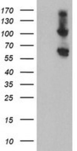 RBM46 Mouse anti-Human, Clone: OTI2A5, lyophilized, TrueMAB 100 &mu;g;