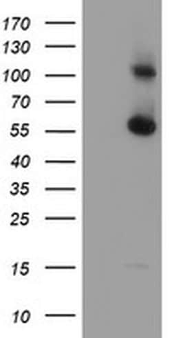 RBM46 Monoclonal Antibody (OTI1D6), TrueMAB , OriGene:Antibodies:Primary