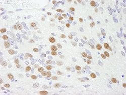 RBM9 Polyclonal Antibody, Bethyl Laboratories 10 &mu;L; Unconjugated:Antibodies,