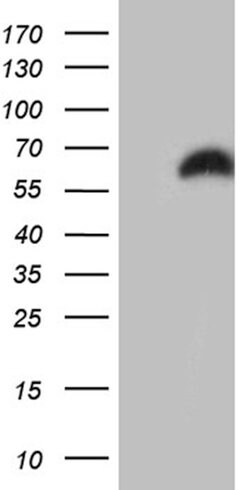 RBMS3 Mouse anti-Human, Clone: OTI8E5, lyophilized, TrueMAB 100 &mu;g;