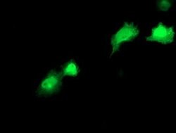 RBP1 Mouse anti-Human, Clone: OTI2E1, lyophilized, TrueMAB 100 &mu;g; Unconjugated:Antibodies,