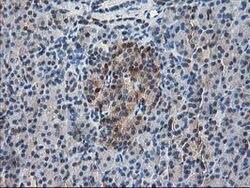 RBP1 Mouse anti-Human, Clone: OTI2E1, lyophilized, TrueMAB 100 &mu;g; Unconjugated:Antibodies,