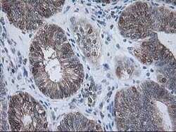 RBP1 Mouse anti-Human, Clone: OTI2E1, lyophilized, TrueMAB 100 &mu;g; Unconjugated:Antibodies,
