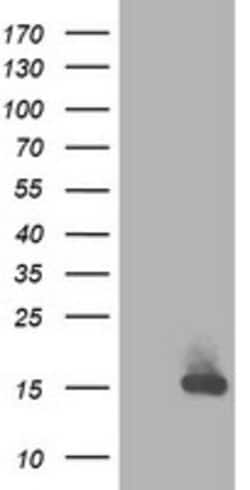 RBP1 Mouse anti-Human, Clone: OTI2E1, lyophilized, TrueMAB 100 &mu;g; Unconjugated:Antibodies,