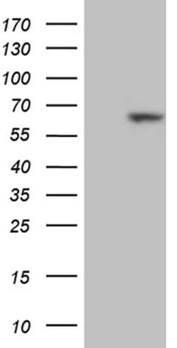 RBPJ Monoclonal Antibody (OTI4B11), TrueMAB , OriGene 30 &mu;L; Unconjugated:Antibodies,