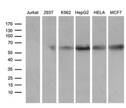 RBPJ Mouse anti-Human, Clone: OTI4B11, lyophilized, TrueMAB 100 &mu;g;