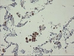 RBPMS Mouse anti-Human, Clone: OTI2G10, lyophilized, TrueMAB 100 &mu;g;