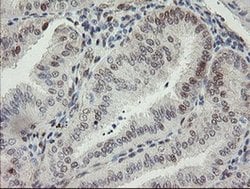 RBPMS Monoclonal Antibody (OTI3D10), TrueMAB , OriGene 100 &mu;L; Unconjugated:Antibodies,