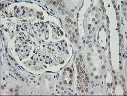 RBPMS Monoclonal Antibody (OTI3D10), TrueMAB , OriGene 100 &mu;L; Unconjugated:Antibodies,