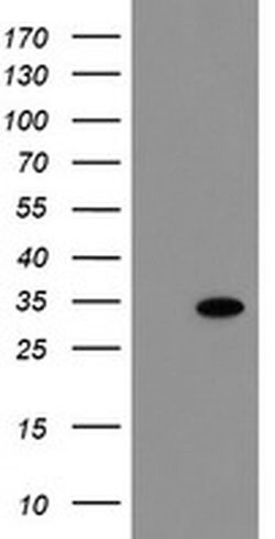 RBPMS Monoclonal Antibody (OTI4F2), TrueMAB , OriGene:Antibodies:Primary