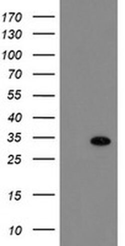RBPMS Monoclonal Antibody (OTI4A11), TrueMAB , OriGene 100 &mu;L; Unconjugated:Antibodies,
