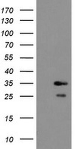 RBPMS Monoclonal Antibody (OTI1C11), TrueMAB , OriGene 100 &mu;L; Unconjugated:Antibodies,